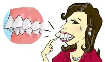 矫正牙齿一般分为几个阶段m.8682.cc