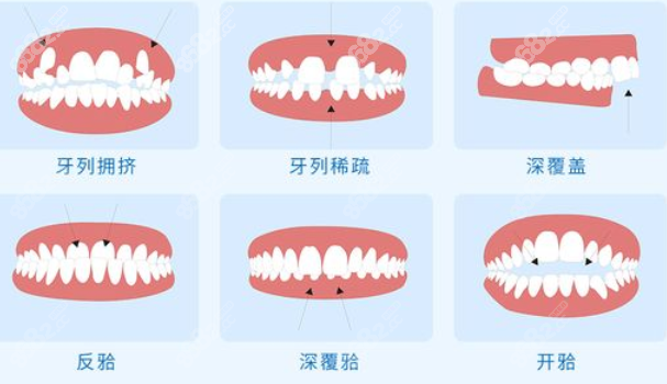 东莞恒生口腔牙齿矫正