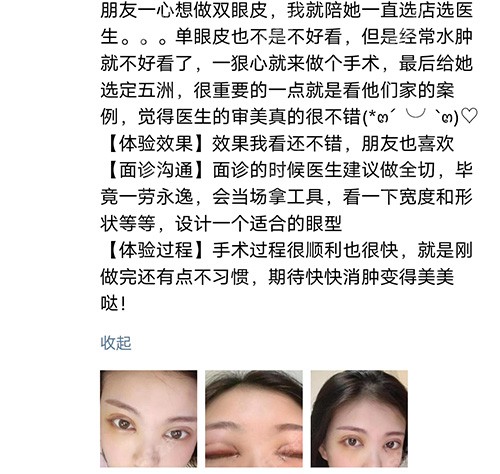 武汉五洲整形医院做双眼皮评价