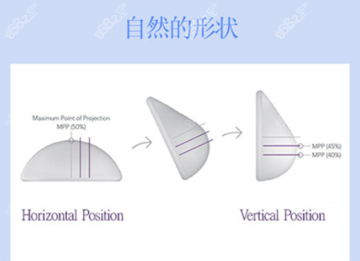 魔滴隆胸假体价格优势