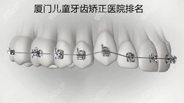 厦门儿童牙齿矫正哪家医院好
