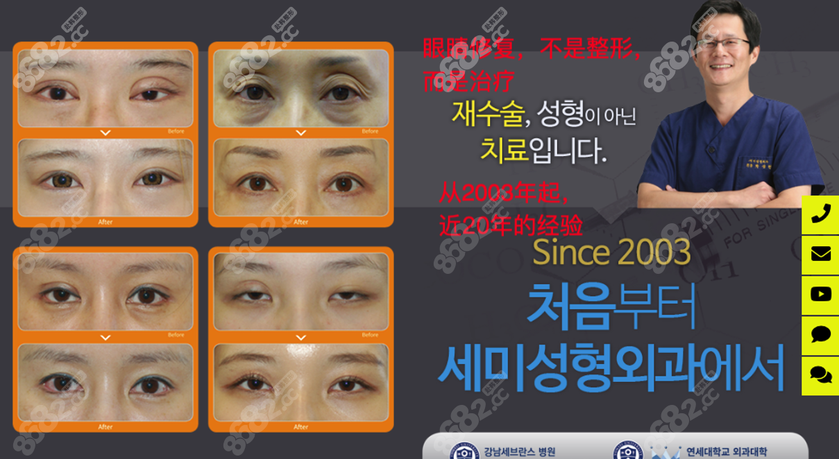 韩国世美医院眼修复价格