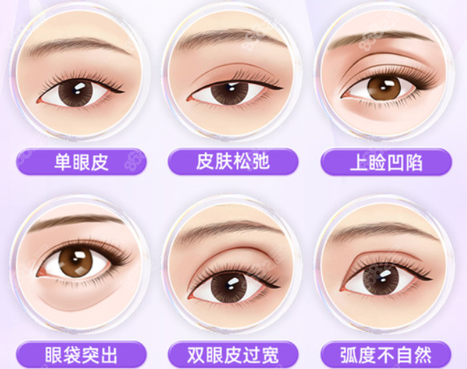 湖州雙眼皮醫(yī)院排行榜