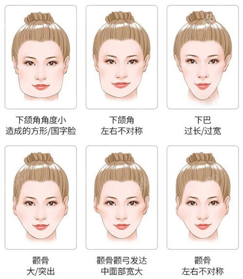 泰国面部轮廓整容医院做磨骨改脸型类型汇总.jpg