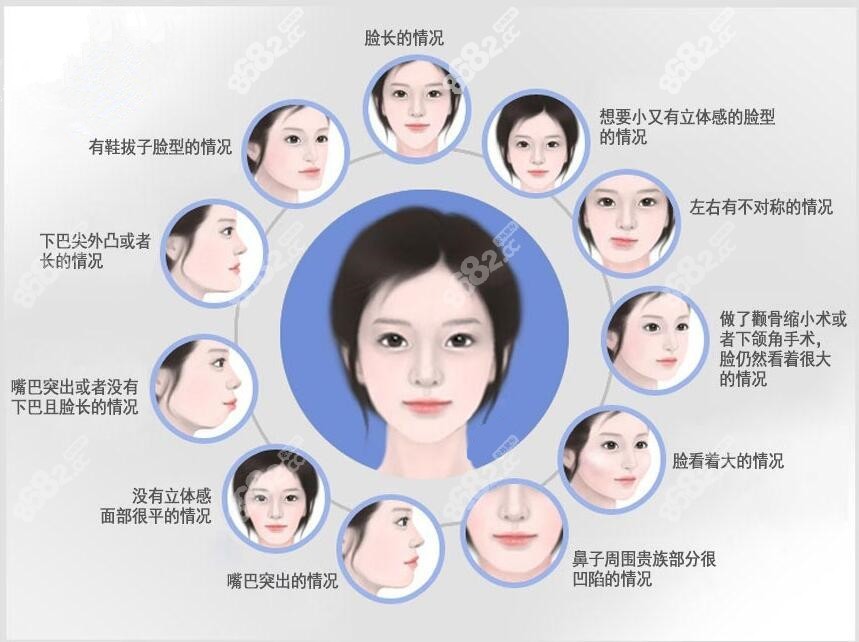 正颌手术可以改善的脸型问题