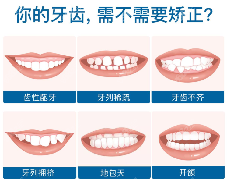 淮南周涛口腔正畸怎么样