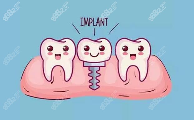 这是种植牙卡通图