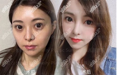 韩国珠儿丽整形外科