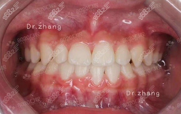 重庆8020口腔牙齿矫正
