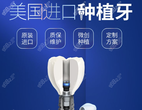 北京中诺口腔医院美国进口种植牙