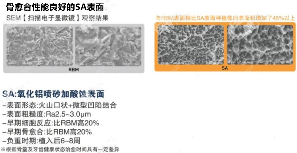 奥齿泰ts3 SA植体表面设计优势