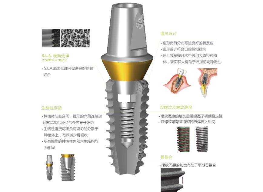 登腾种植牙价格之所以便宜8682.cc