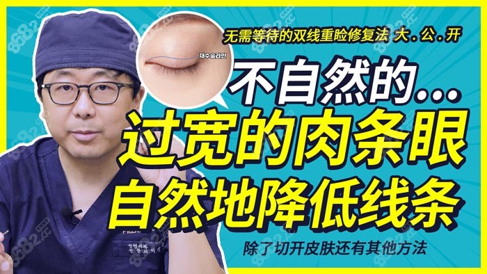 韓國ts整形做雙眼皮修復(fù)好嗎 韓國ts整形做雙眼皮修復(fù)好嗎