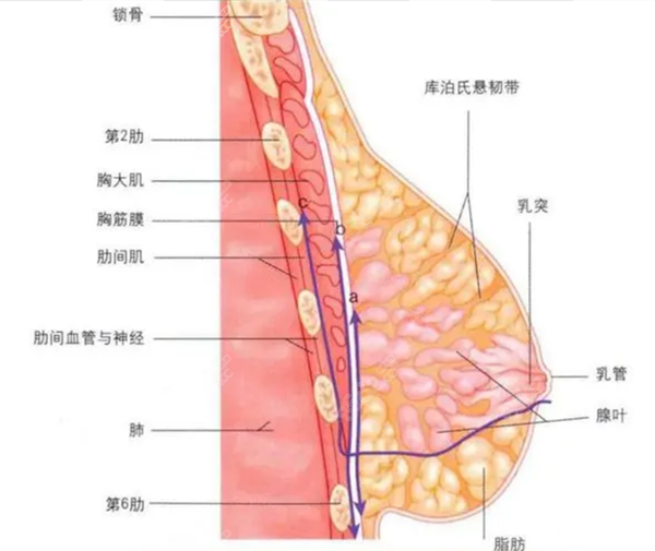 假体隆胸用乳晕切口优势