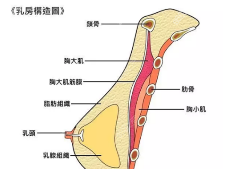 假体隆胸手术