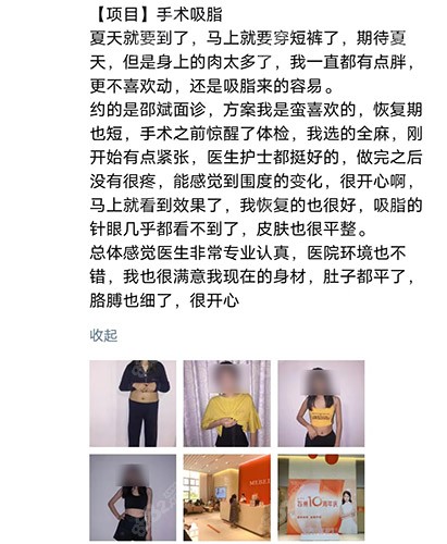 苏州美贝尔邵斌医生吸脂口碑评价