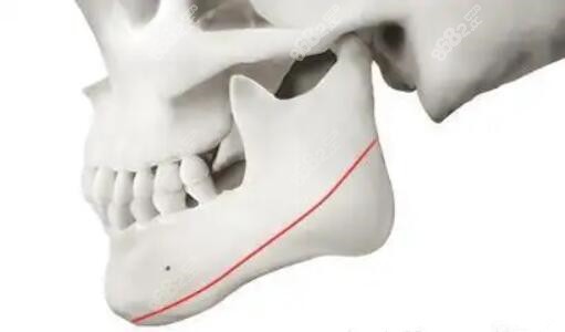 石家莊做下頜角m.8682.cc