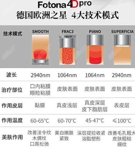 欧洲之星Fotona4D