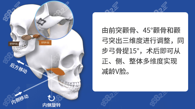 西安改臉型醫(yī)院哪家好