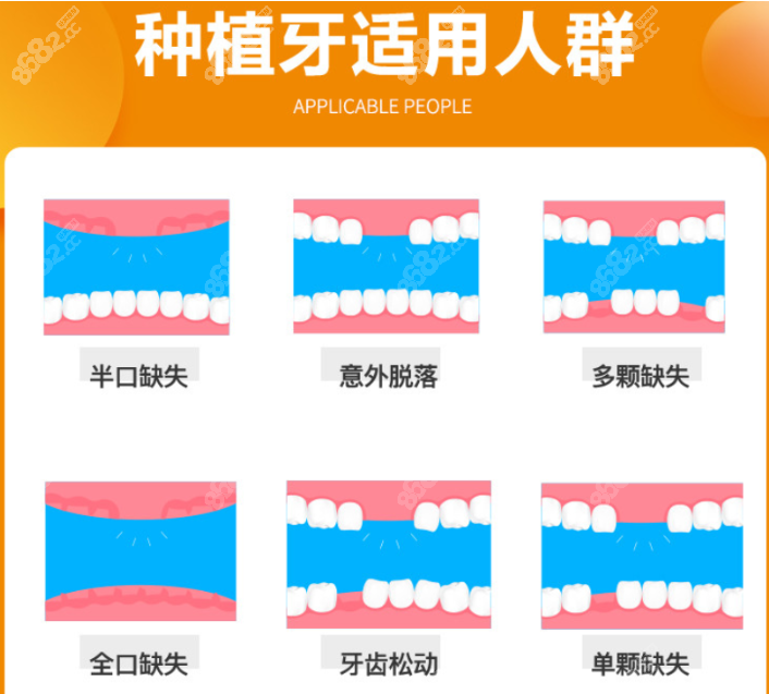 合肥登特尔口腔种植牙怎么样