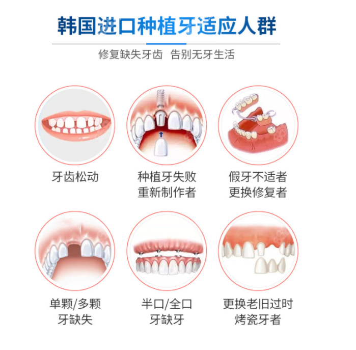 合肥登特尔口腔种植牙怎么样