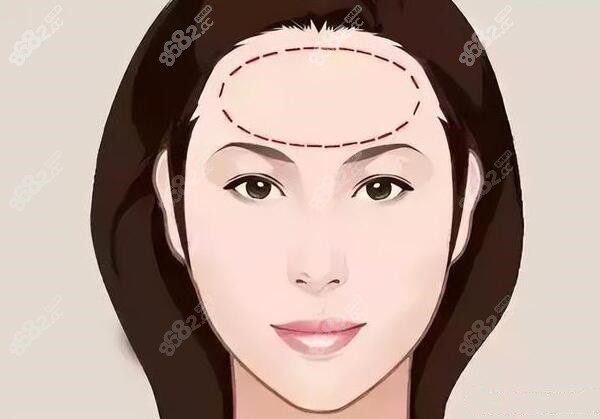 韓國額頭整形醫(yī)院排名榜8682.cc