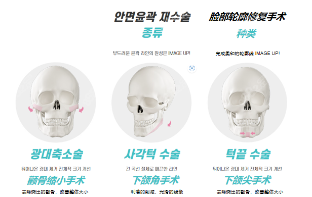 韩国伊美芝整形面部轮廓修复手术类型