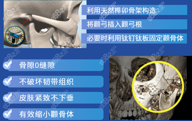西安國醫(yī)改臉型技術(shù)好
