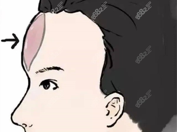 韓國做額頭整形好的醫(yī)院名單