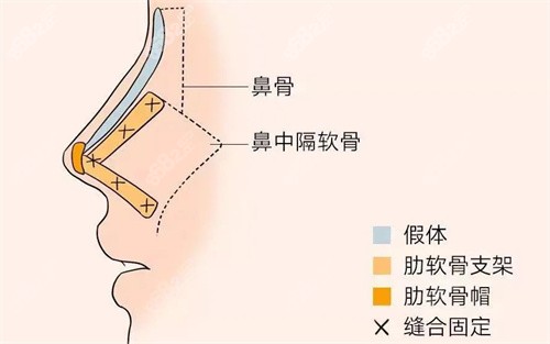 半肋骨鼻的内部组织分析