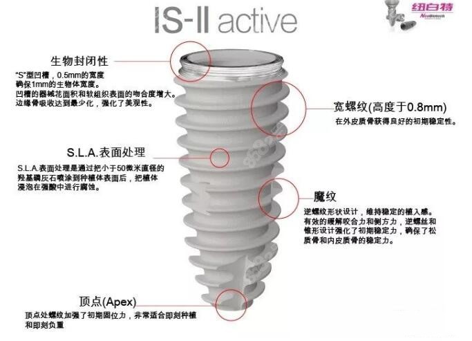 韩国纽百特种植体优点