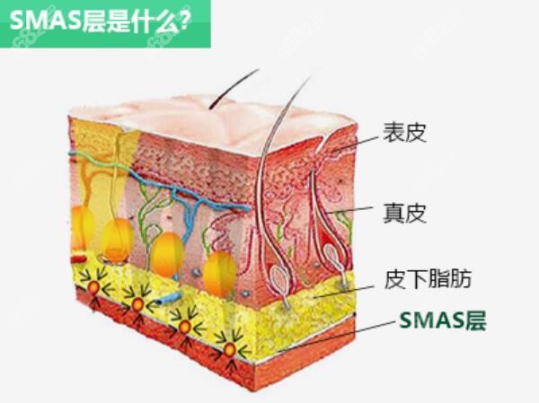 SMAS面部提拉术是什么m.8682.cc