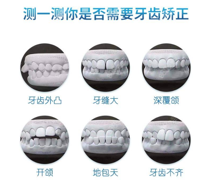 大连唯格口腔矫正牙齿怎么样