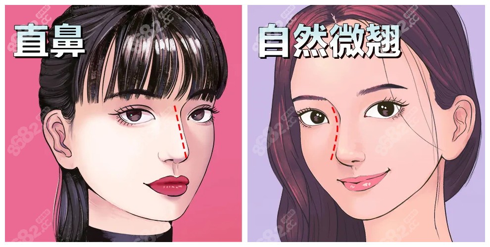 王旭明隆鼻实例图片看王旭明做鼻子风格自然www.8682.cc