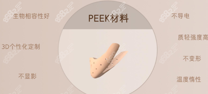 peek材料是什么