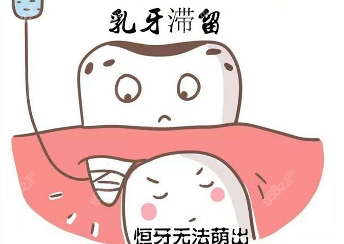 长治拔乳牙滞留的费用不贵