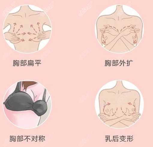 四會(huì)紫盈做隆胸技術(shù)好8682.cc 四會(huì)紫盈做隆胸技術(shù)好8682.cc