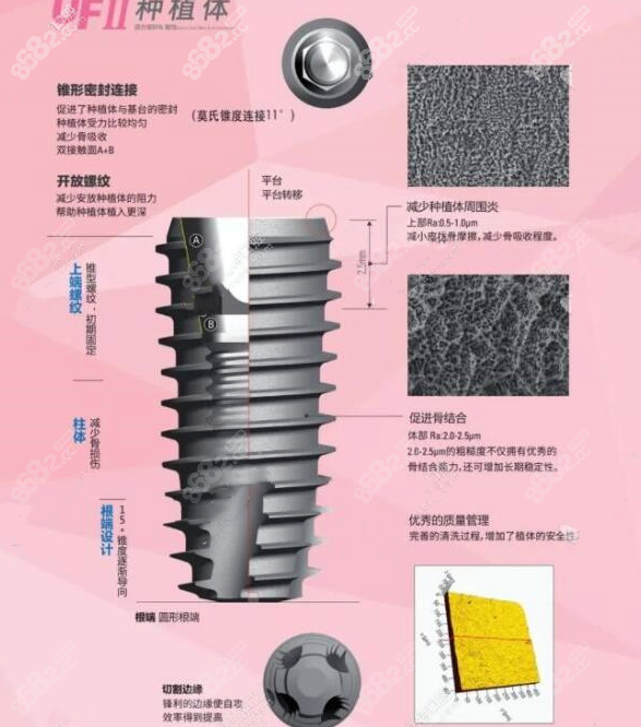 韩国dio种植体二代UFII