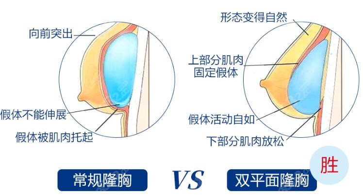 唐新辉隆胸