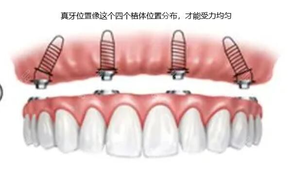 真牙分布位置要均匀