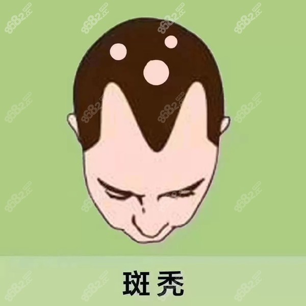 利特昔替尼胶囊