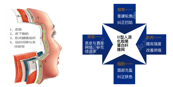 伊维兰III型胶原蛋白适合填充部位有哪些