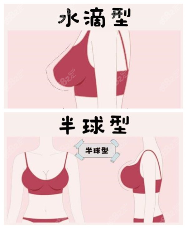 标准胸型是什么型