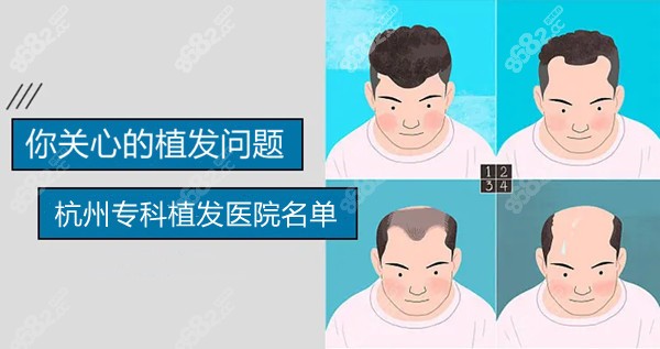 杭州有哪些专科植发医院？