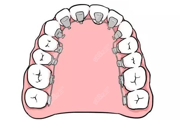 铜陵牙齿矫正舌侧多少钱m.8682.cc