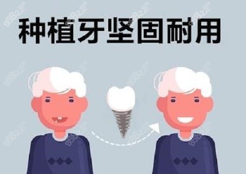 种植牙漫画