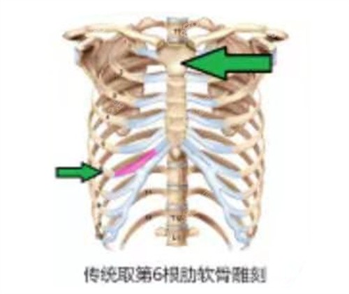 上海时光隆鼻医生宋茂启肋软骨鼻综合技术可靠