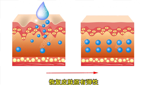 面部填充优势