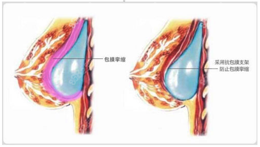 中国胸修复医院排行榜