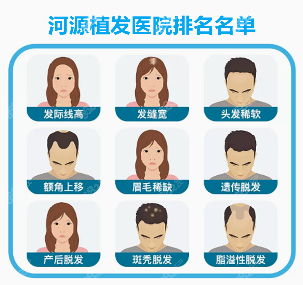 河源植发医院排名名单公布 8682.cc